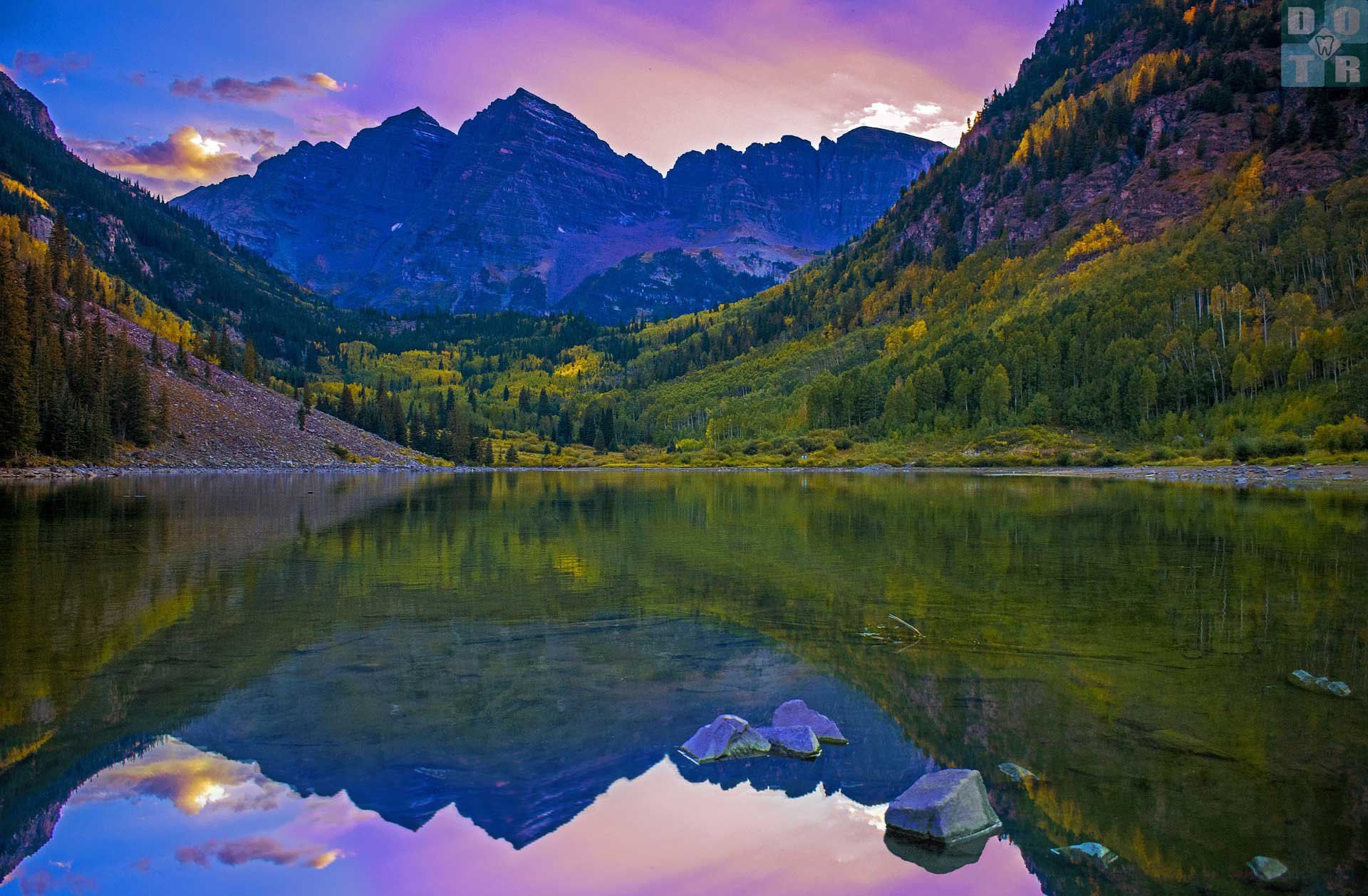 Dentaltemps of the Rockies